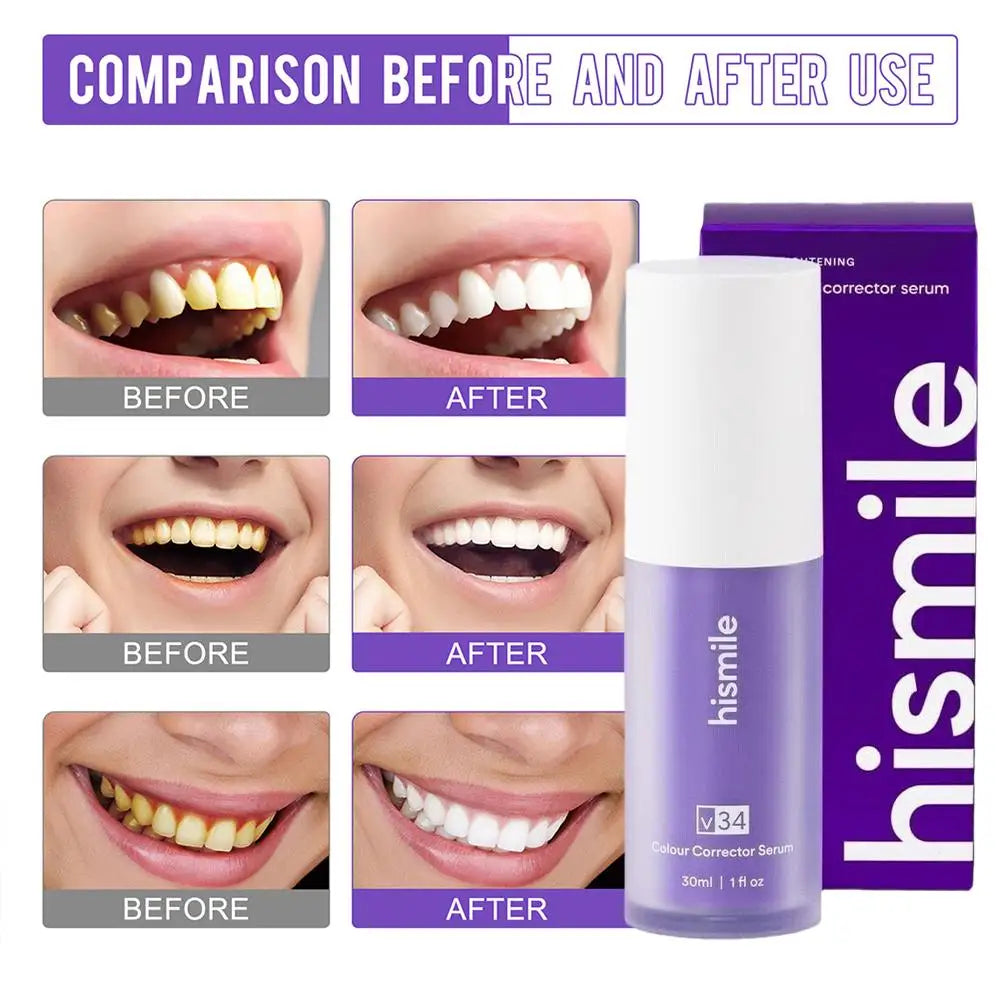 30ml Hismile V34 Purple Teeth Whitening Foam Press Type Color